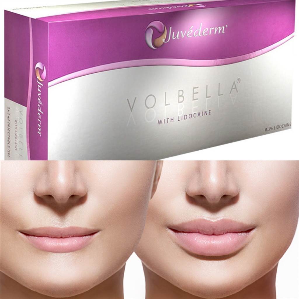 Juvéderm Volbella (2 x 1mI)