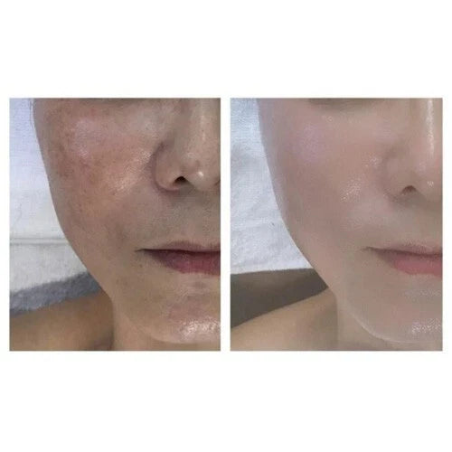 DM Cell - Organic Bio Seacil Exfola Peel Treatment Kit