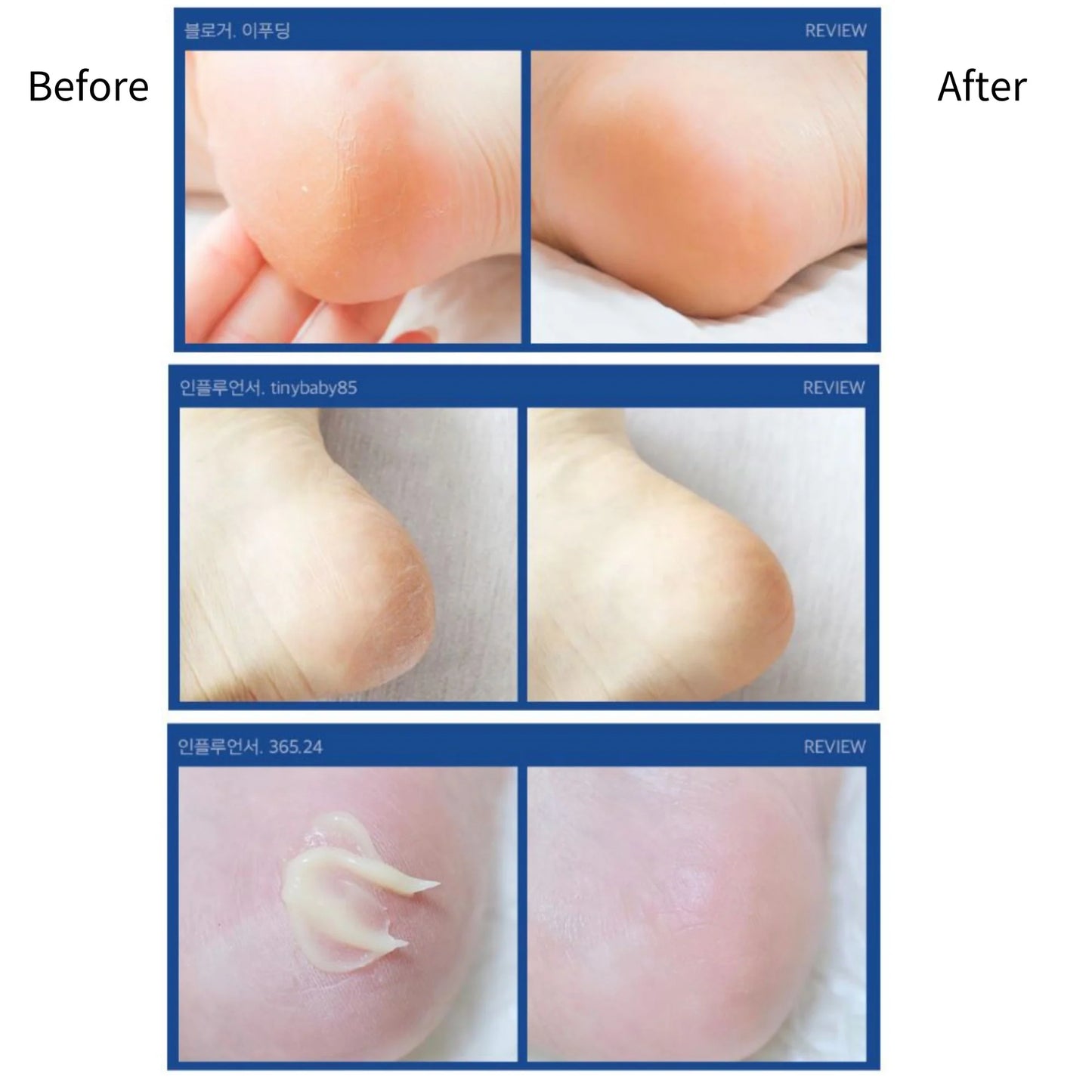 Medipeel - EGF Scaling Moisture Foot Cream