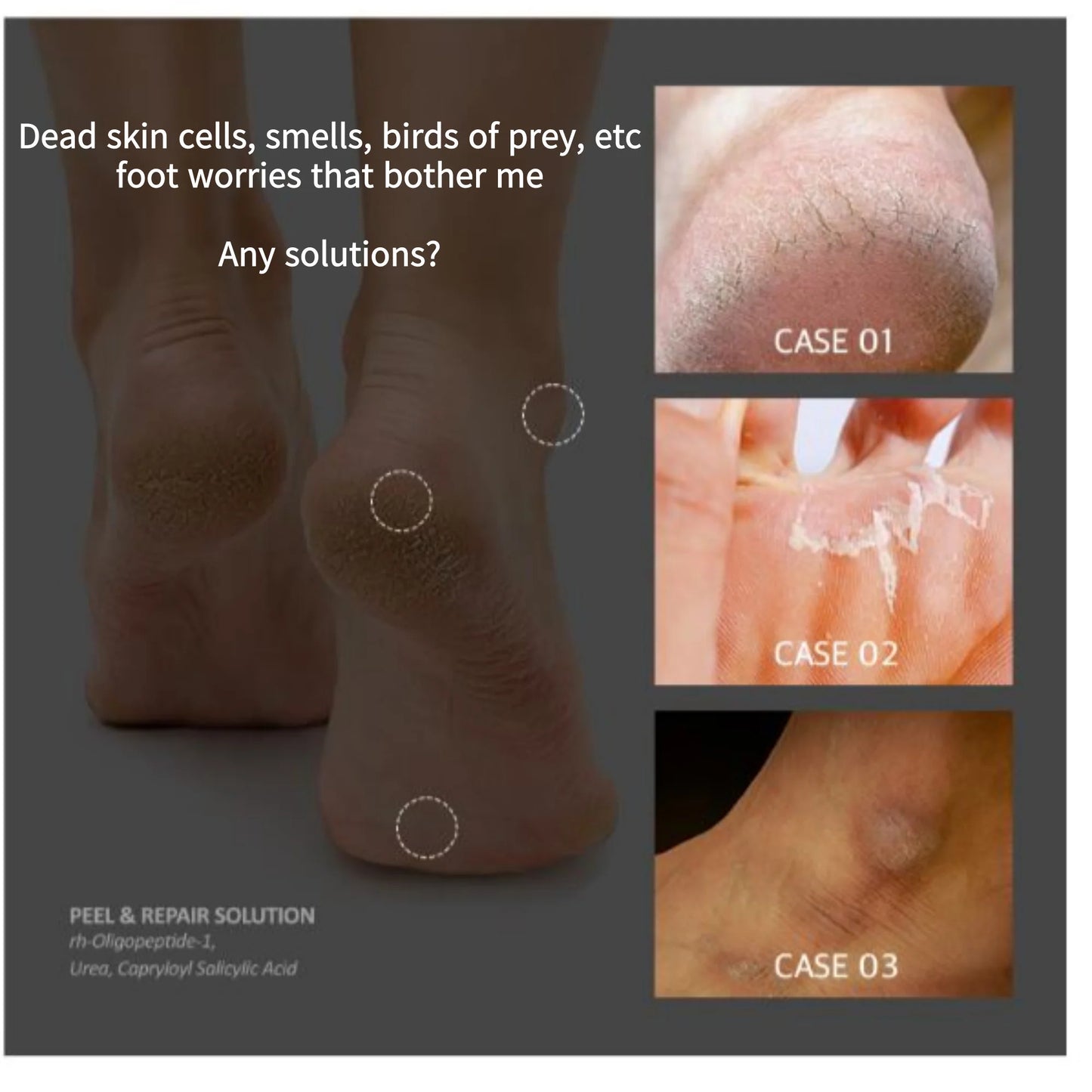 Medipeel - EGF Scaling Moisture Foot Cream
