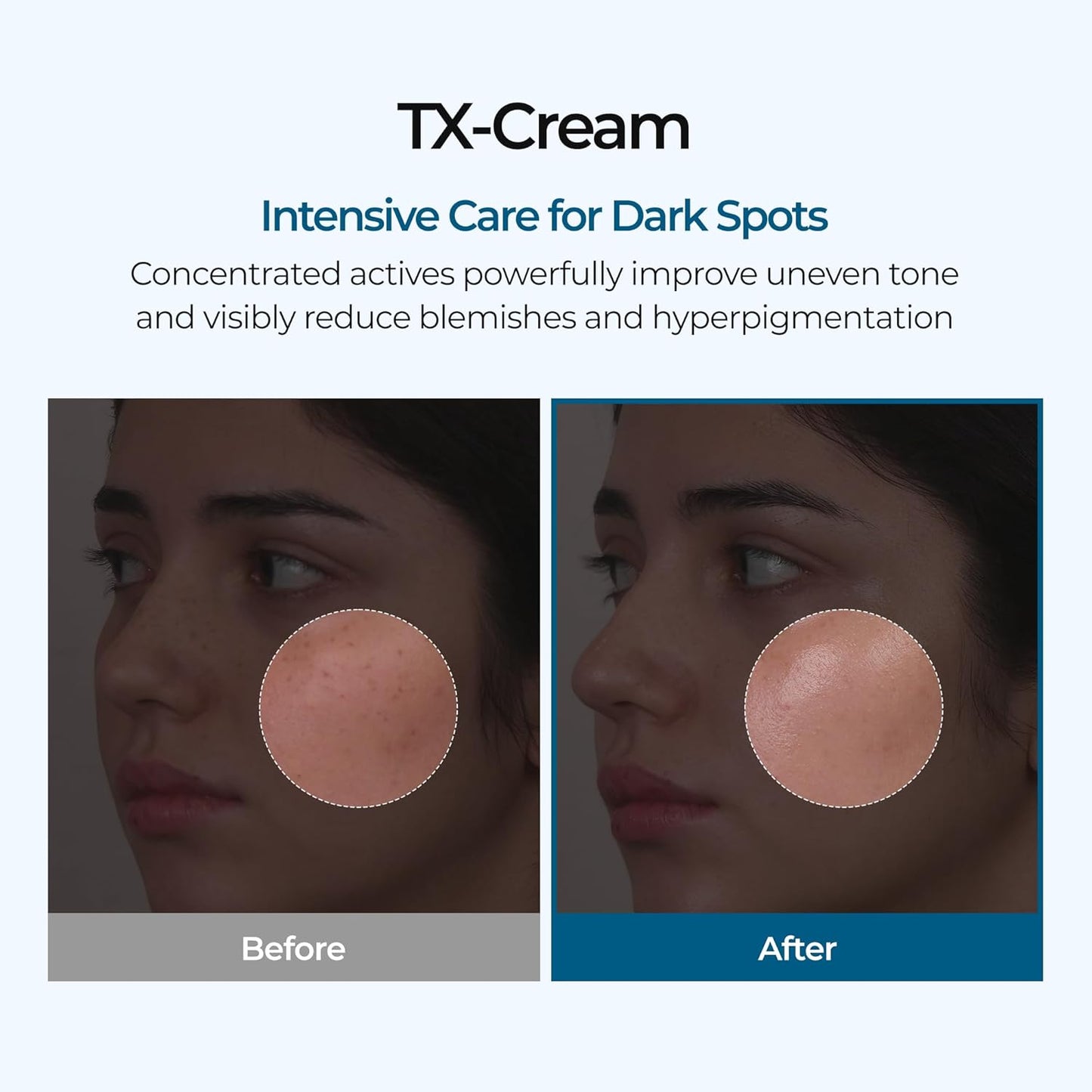 Dr. Melaxin - TX Cream 50mL