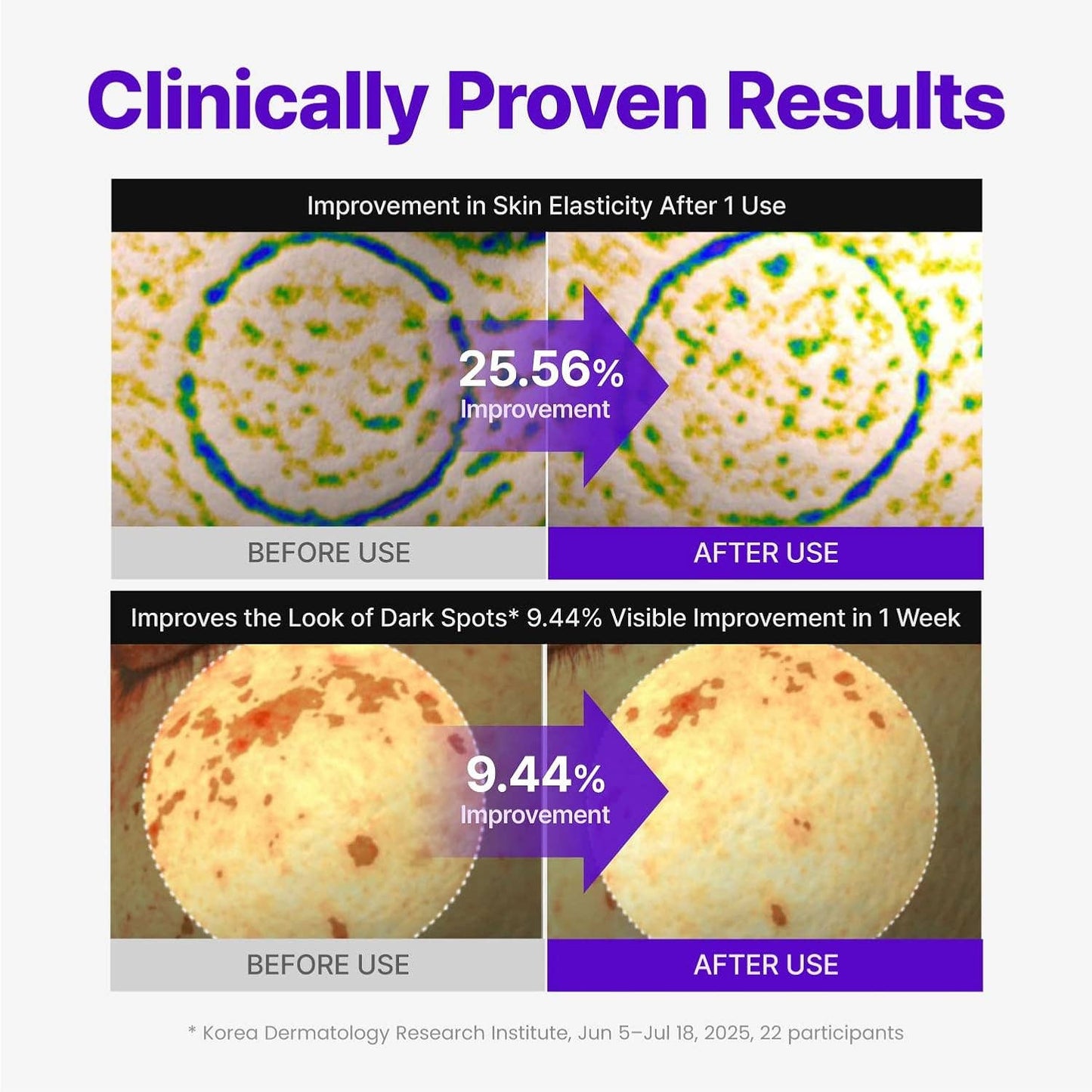 CENTELLIAN 24 Expert Madeca Cream Active Renew PDRN