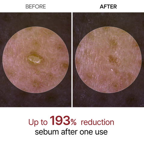 Dr.Melaxin - Peel Shot Exfoliating Black Rice Ampoule