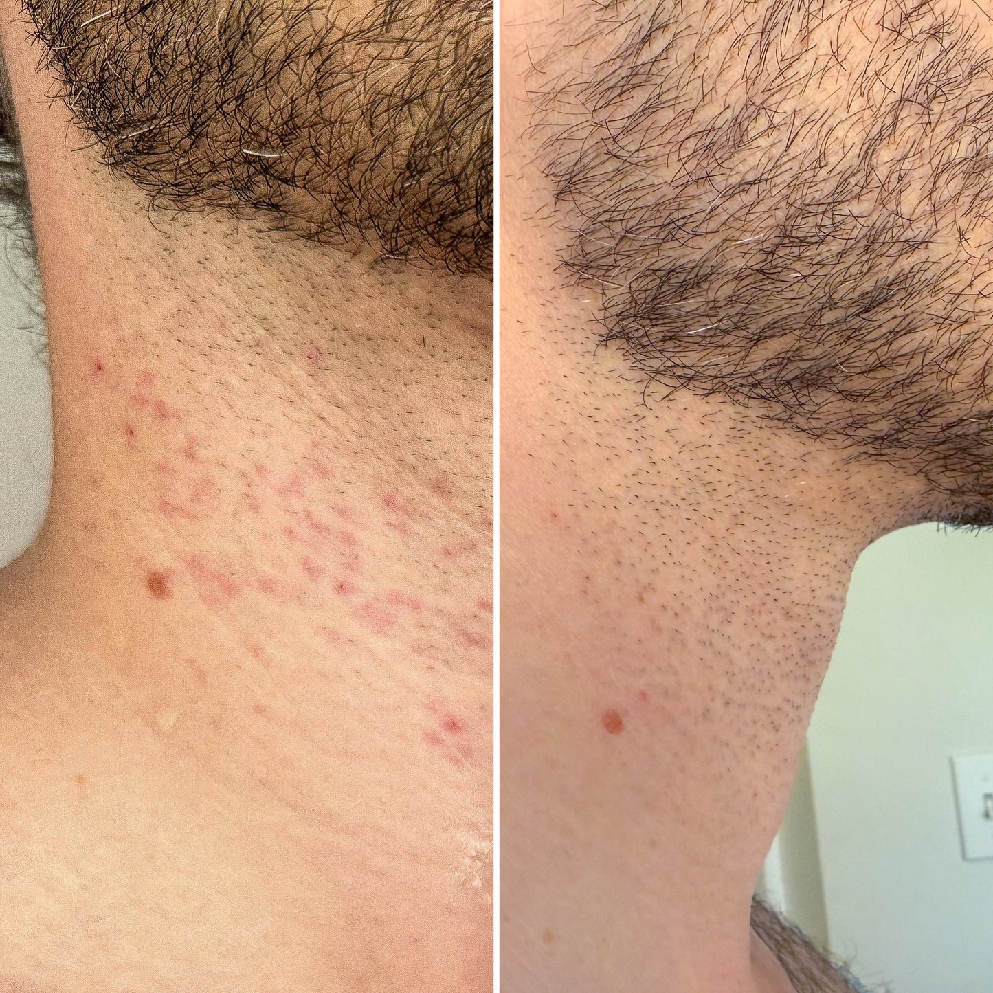 Bruh. The Recovery Mist 4fl.oz