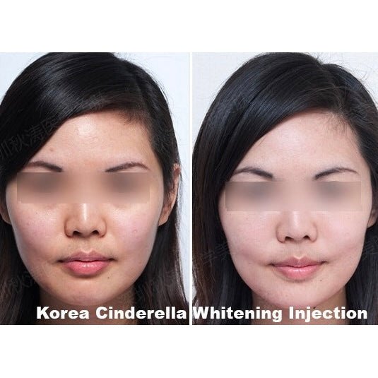 Before and after photos of a woman's face, showing skin whitening results.