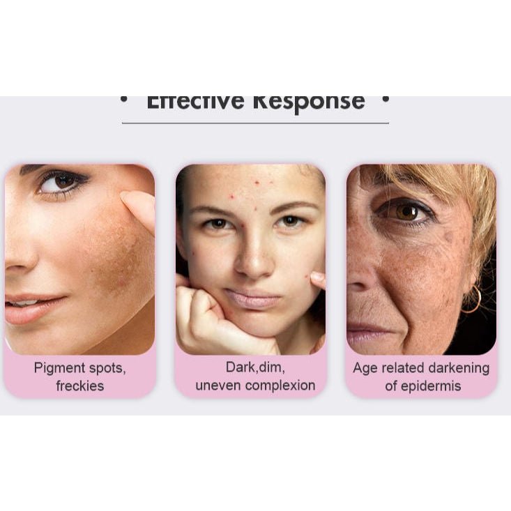 Three images show skin concerns: pigment spots, uneven complexion, and age-related darkening.