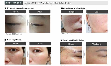 Curestem Cell Healer C20 - XQ