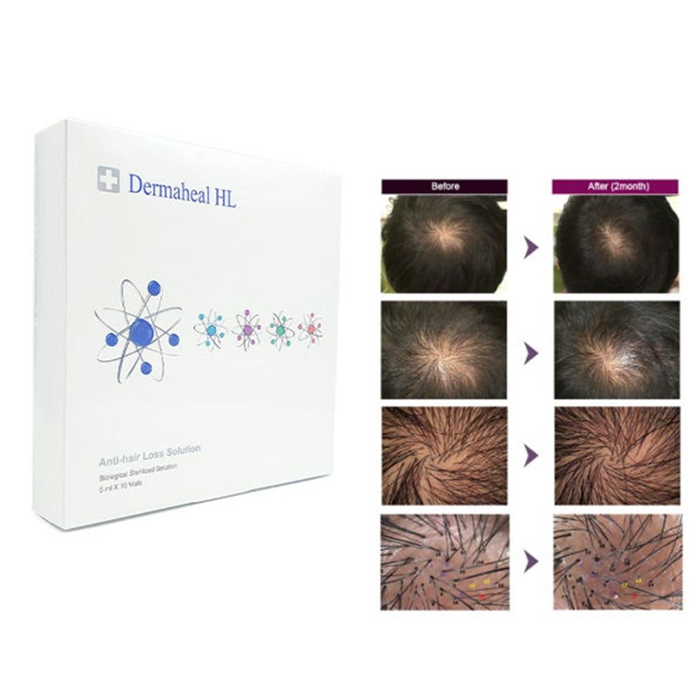 A white box of Dermaheal HL Anti-hair Loss Solution with before and after hair growth images.