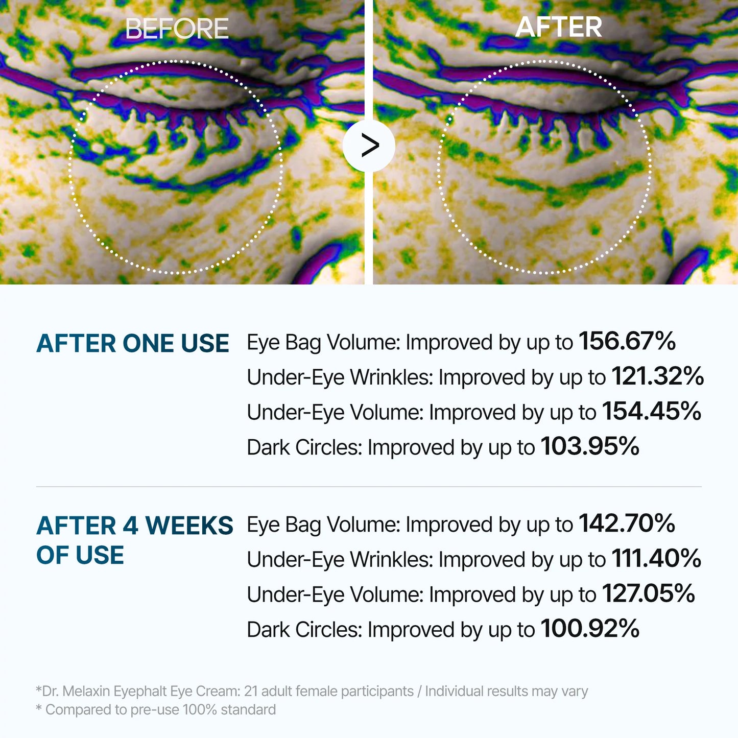 Dr.Melaxin - Eyephalt Eyebag Cream 10ml
