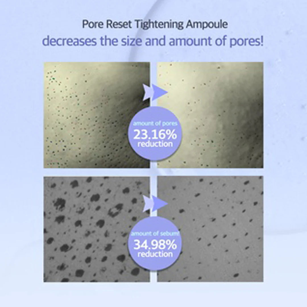 Luvum - Pore Reset Tightening Ampoule 30ml