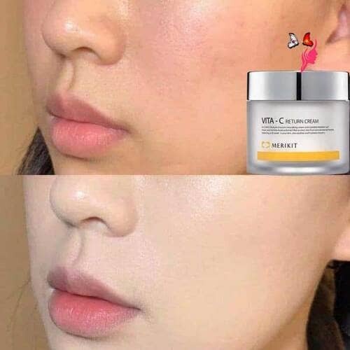 A split image shows a person's face before and after using Merikit Vita-C Return Cream.